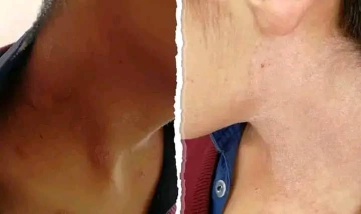 سیستم منفعل بهداشت در بامیان و شیوع بیماری‌های نا‌شناخته‌ی جلدی